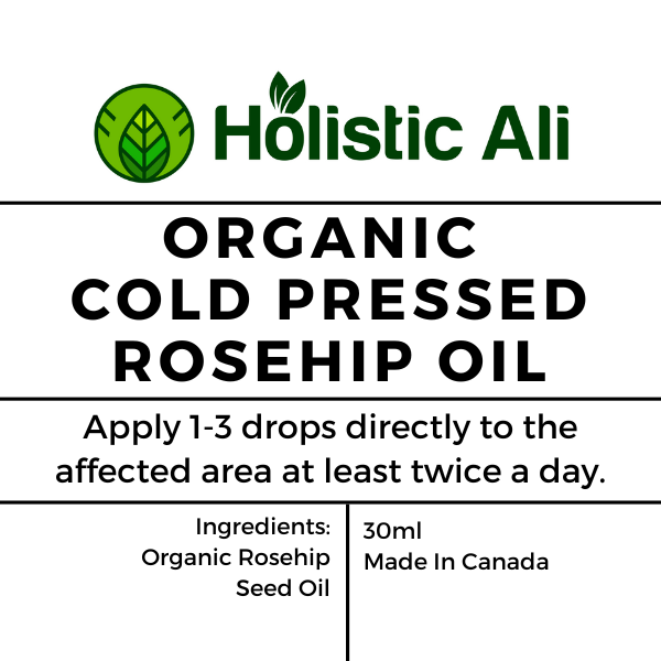 Organic Cold Pressed Rosehip Oil 30ml